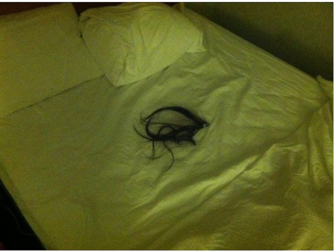 Chunks Of Hair In Bed