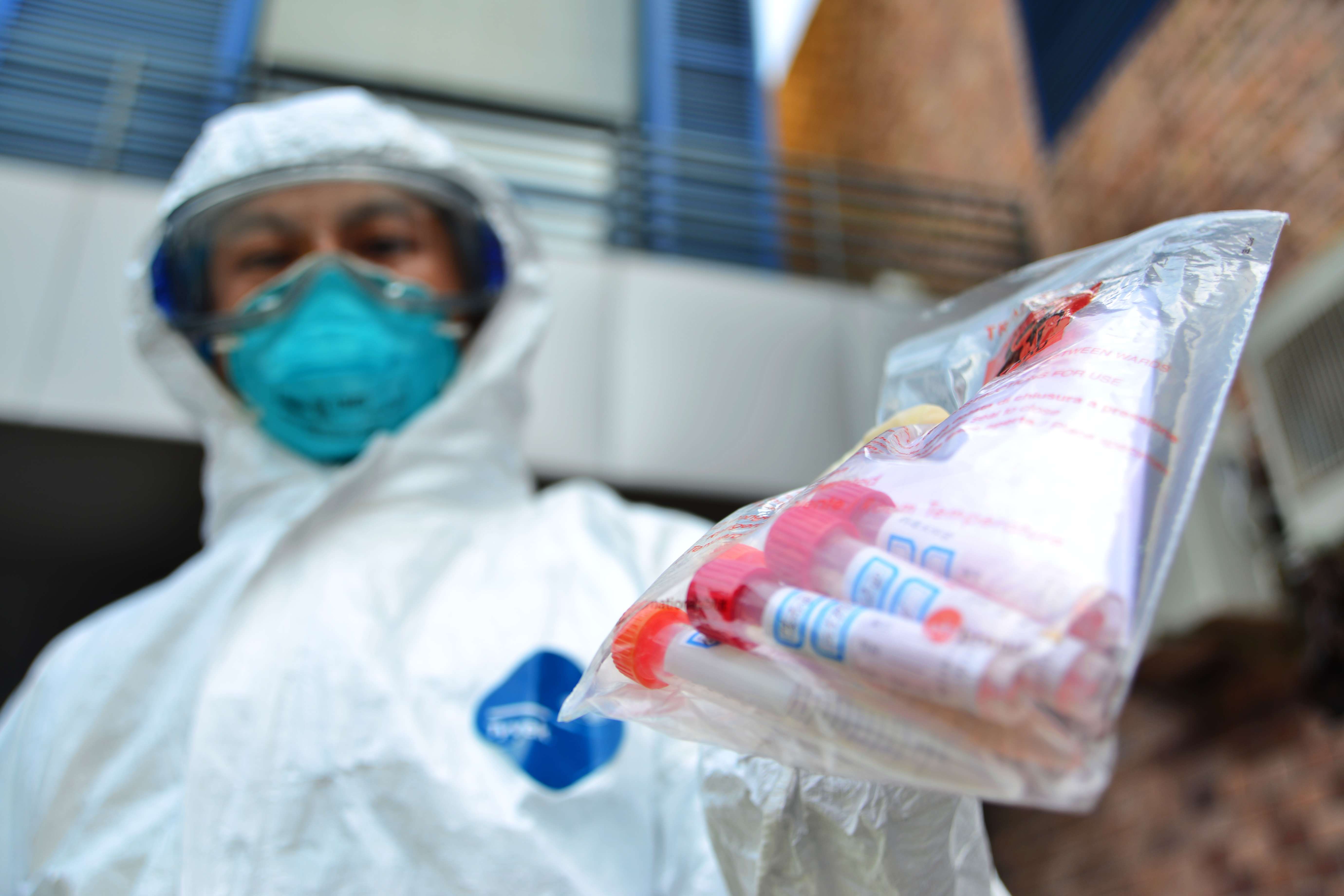 Avian flu virus detection