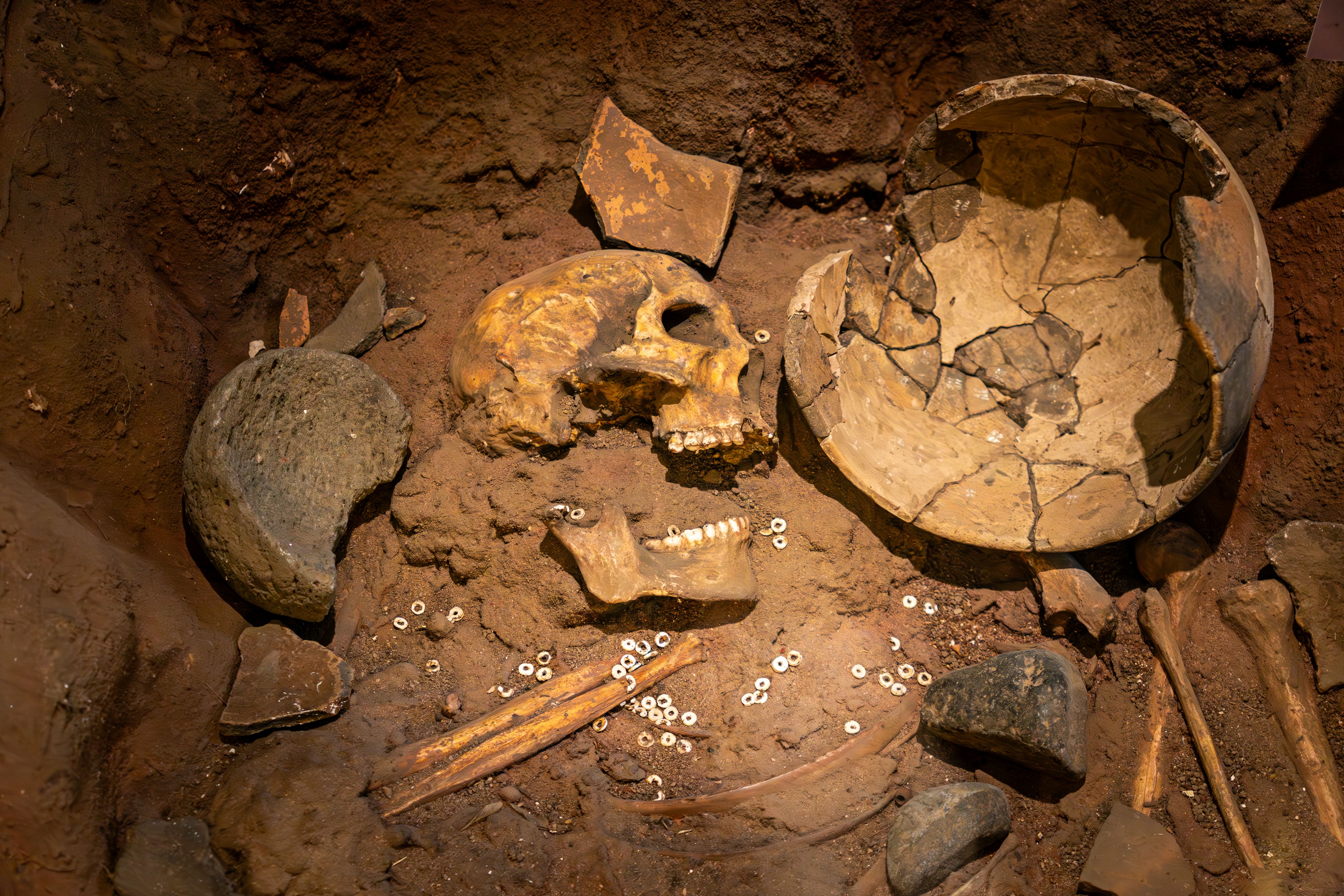 Skull bones